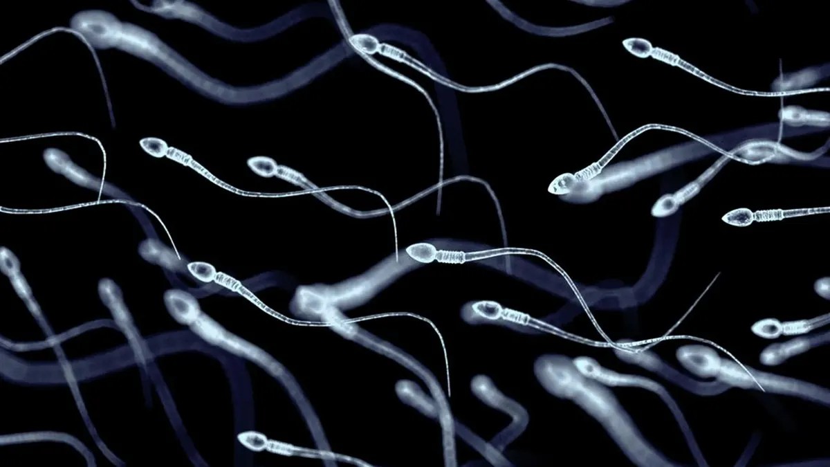 Una mutación genética en un donante de esperma puede causar cáncer a 200 niños