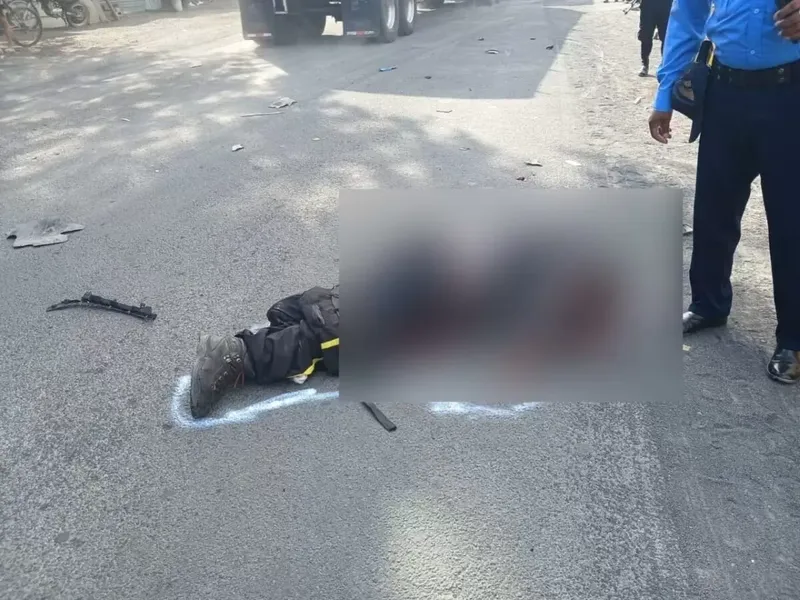 Vigilante al borde de la muerte tras choque entre automóvil y moto en Comarca Veracruz