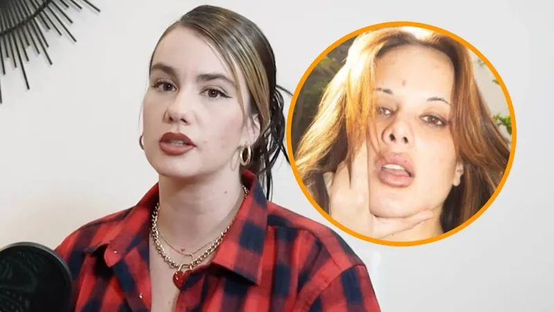 ¿Gala Montes CAYÓ EN ADICCIONES? Su hermana ‘Beba’ se sinceró y contó si consume sustancias