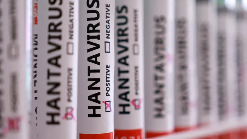 Argentina reporta aumento de casos de hantavirus y alta mortalidad