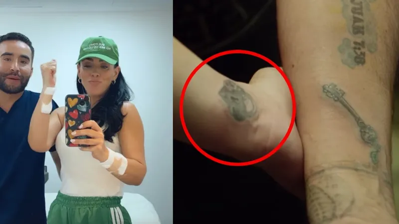 Marichelo se arrepiente de los tatuajes que se hizo por amor a Jorge D’Alessio y empezó a borrarlos