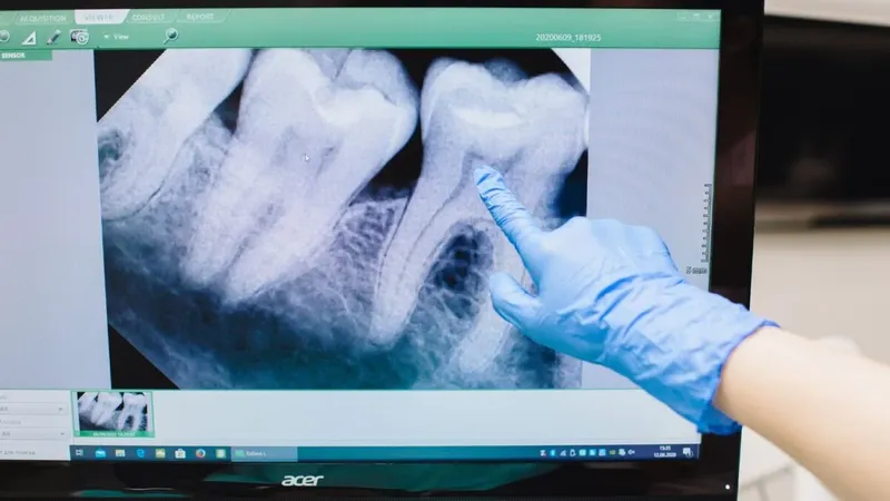 La odontología se prepara para su salto robótico: un minirobot ya puede tallar dientes con precisión milimétrica