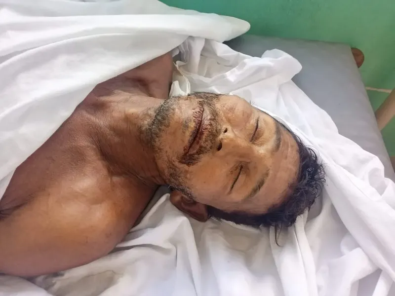 Desconocido fallece por broncoaspiración en el Hospital de El Cuá