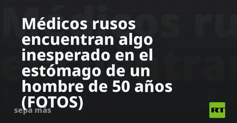 Médicos rusos encuentran algo inesperado en el estómago de un hombre de 50 años (FOTOS)