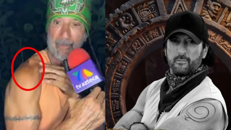 Bobby Larios sale de Survivor con una impactante lesión: “Me tengo que someter a una operación”