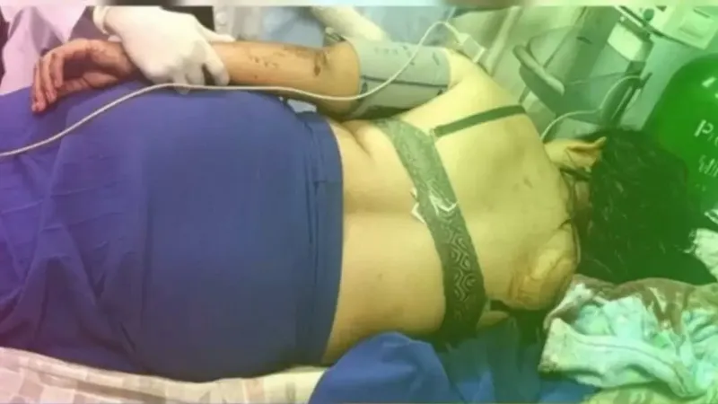 Mujer queda crítica tras ser macheteada por su ex en El Rama