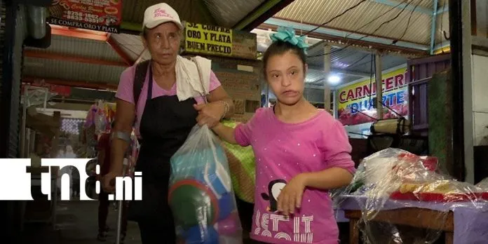 María Lourdes enfrenta la vida con un ojo menos y muchas ganas de luchar