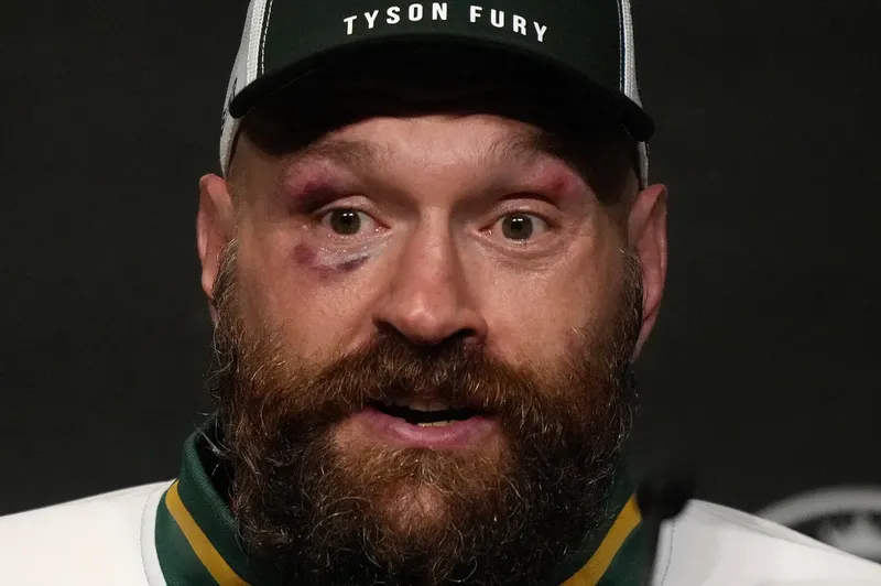 ¿Se hará un combate entre Eddie Hearn y Dana White?, Tyson Fury ofrece su ayuda