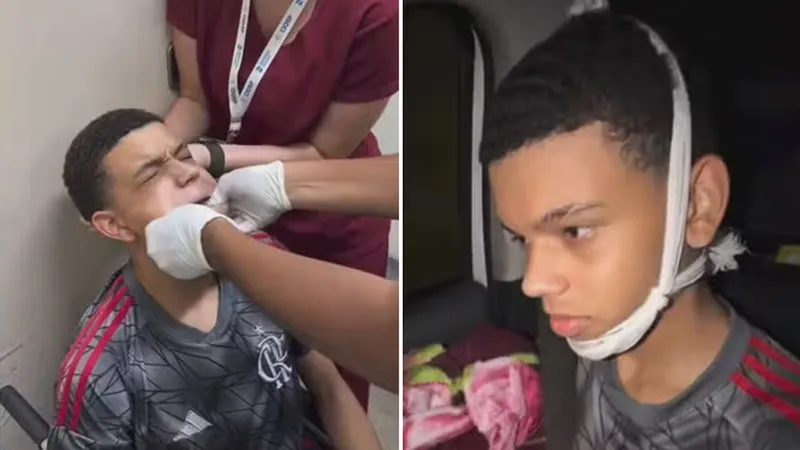 VIDEO: Bosteza y termina en urgencias por esta razón