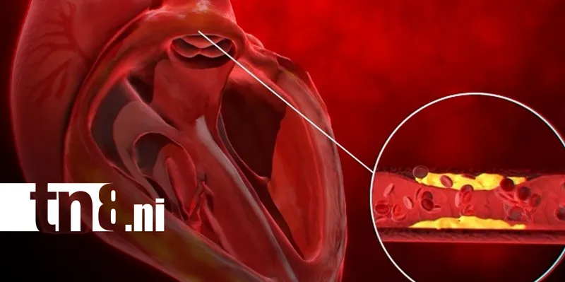 La presión arterial alta puede dañar tu corazón sin que lo notes