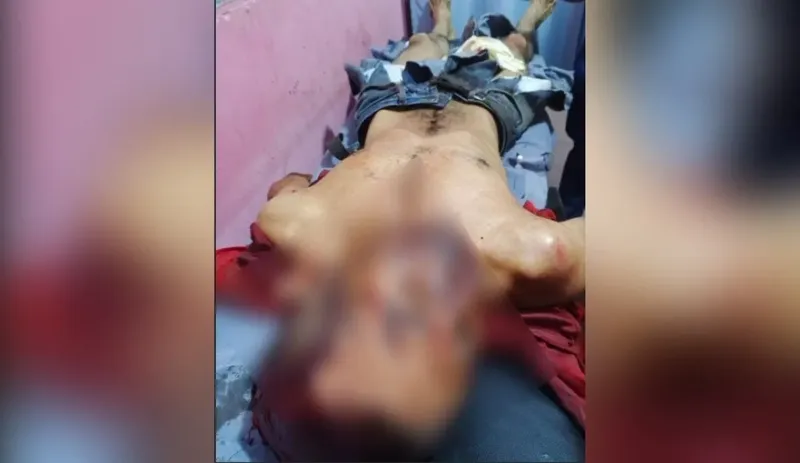 Hombre se debate entre la vida y la muerte tras ser atacado a machetazos en Nueva Segovia