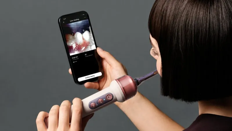 Dyson entra al cuidado dental con CameraJet: un cepillo con cámara e IA que detecta dónde debe irrigar