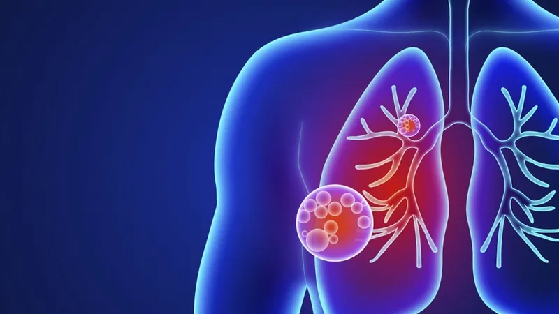 MINSA confirma aumento de neumonía y malaria en última semana