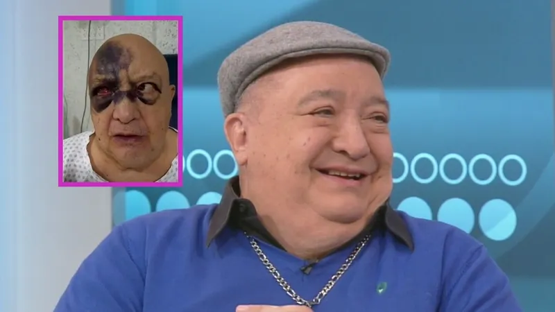 Hospitalizan a Luis de Alba y aparece todo moreteado de la cara: “Ya me andaban matando”