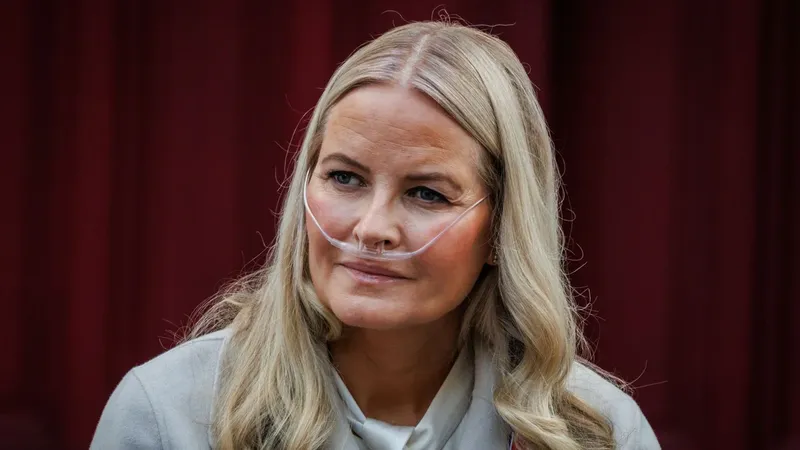 Preocupa la salud de la princesa Mette-Marit tras ser incluida en la lista para trasplante de pulmón