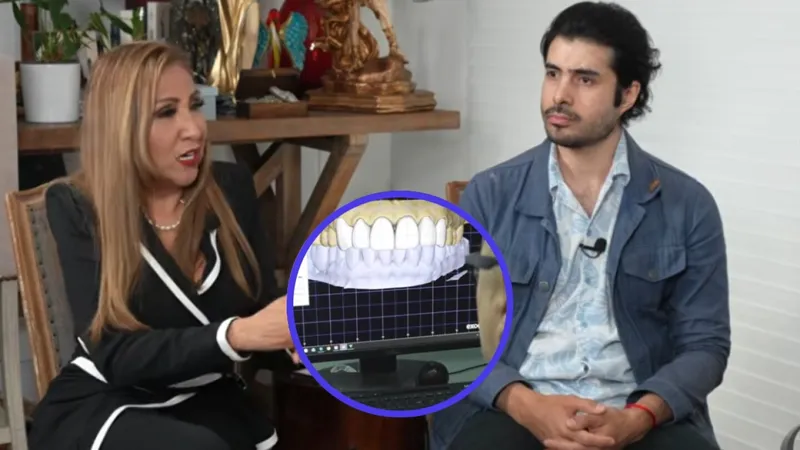 ¿Es muy cara la reconstrucción maxilar que requirió José Ángel Bichir tras su caída de un tercer piso?