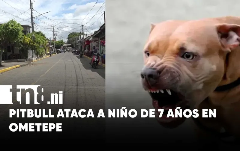 Niño de 7 años sufre graves heridas tras ataque de un pitbull en Ometepe