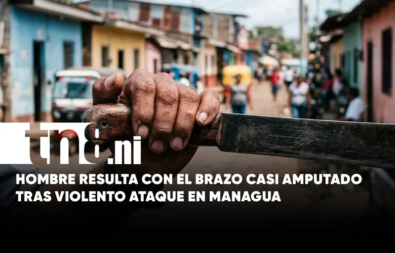 Hombre queda con el brazo casi amputado tras ataque con machete en Managua