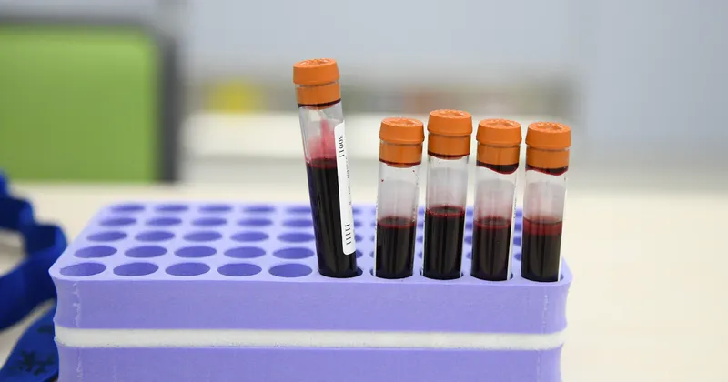 Comité de la FDA respalda prueba de sangre de Grail para detectar múltiples tipos de cáncer