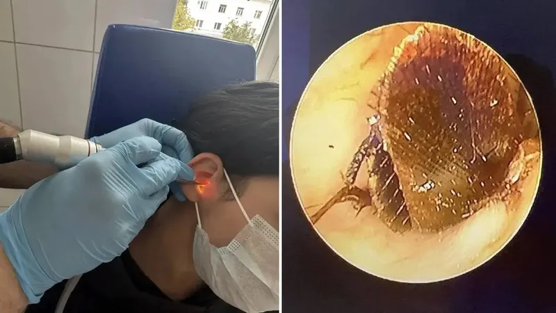 Mujer rusa va al médico por un fuerte dolor y descubren algo aterrador en su oído