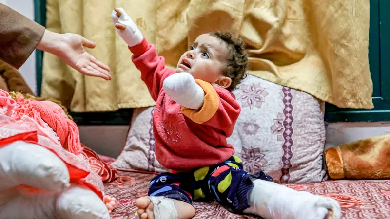 ONU denuncia amputaciones en niños tras ataques israelíes en Cisjordania