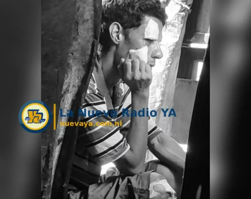 Rudy Huerta Bravo días después de ser atropellado en Juigalpa