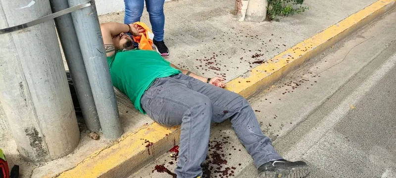 Motociclista sufre heridas en manos tras caer en la calle del IND en Managua