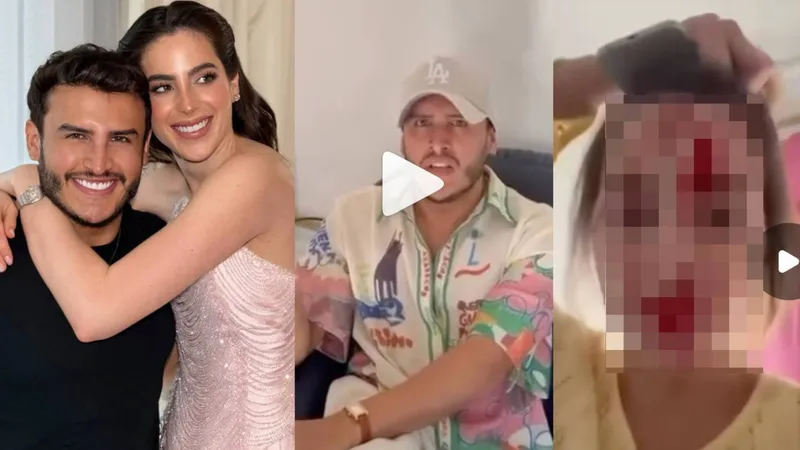 Arrestan a maquillista y amigo de Fátima Bosch por propinarle FEROZ GOLPIZA a ‘Miss Venezuela’