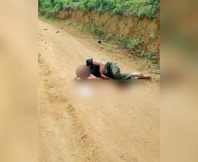 Motociclista queda grave en La Conquista tras accidente en Santa Elena