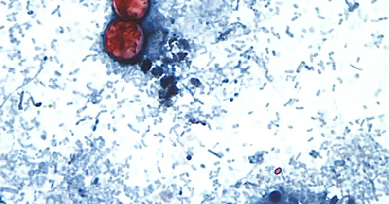Investigan brote de Cyclospora, un parásito vinculado a diarrea severa, en 31 estados de EE.UU.
