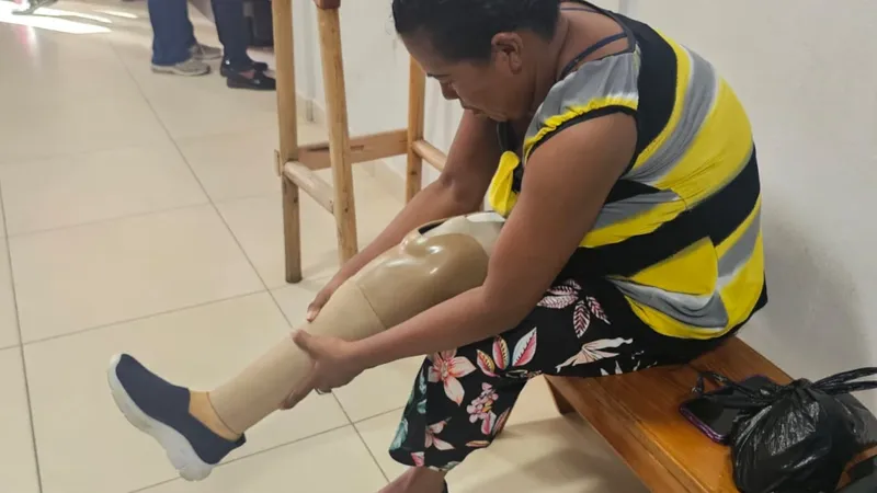 Bilwi fortalece atención a personas con discapacidad con prótesis y órtesis elaboradas a la medida