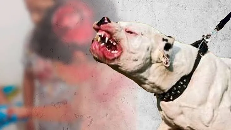 Tercer ataque de perro pitbull en Masaya deja a menor con 75 puntadas en su rostro