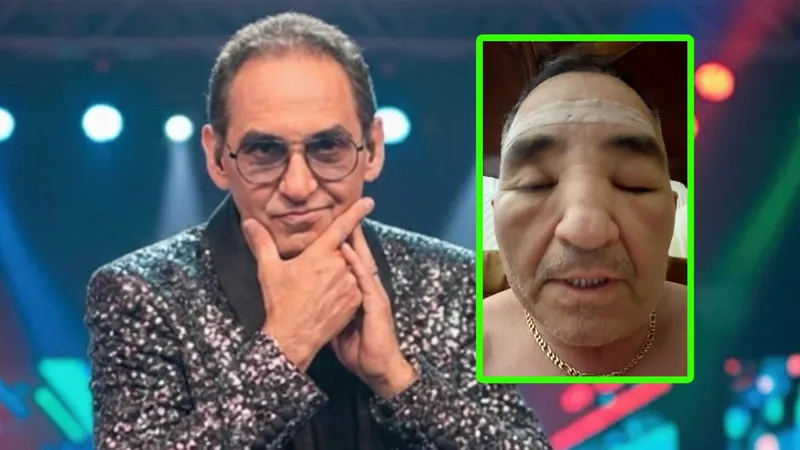 Ernesto Chavana aparece con el ROSTRO DESFIGURADO: un ojo cerrado y moretones; ¿qué le pasó?