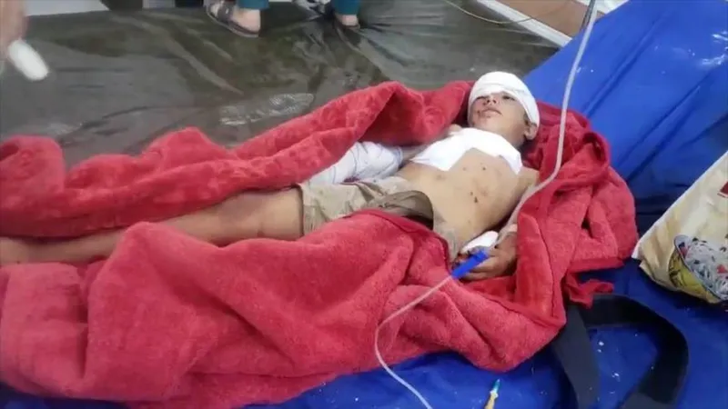 Ataques saudíes contra Yemen dejan tres niños muertos y 17 civiles heridos
