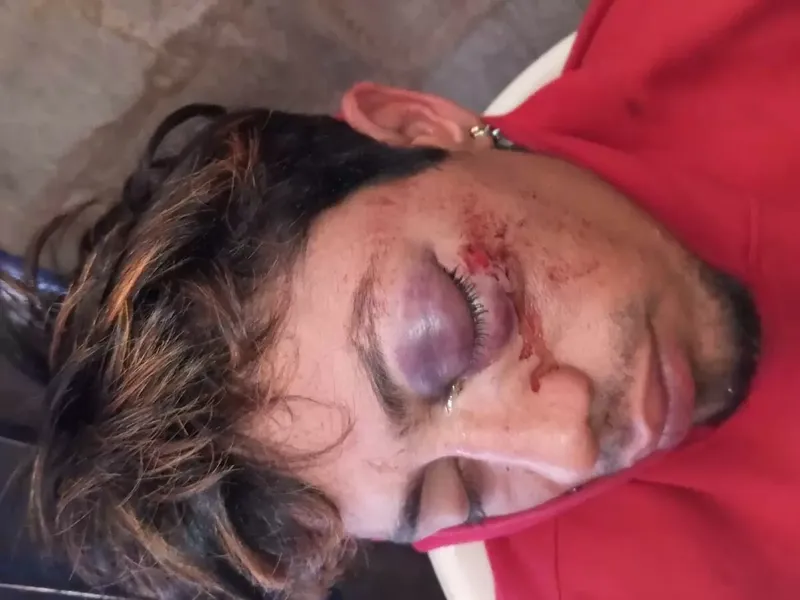 Agreden con cuchillo a joven en barrio Oscar Gámez de Estelí