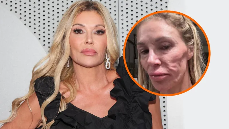 Estrella de ‘Real Housewives of Beverly Hills’ tiene un TUMOR EN LA CARA que contrajo por vía s3xu4l