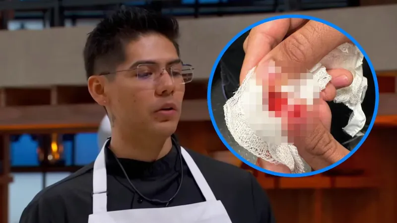 Participante de ‘Masterchef 24/7’ pierde PARTE DEL DEDO tras cortarse con un cuchillo