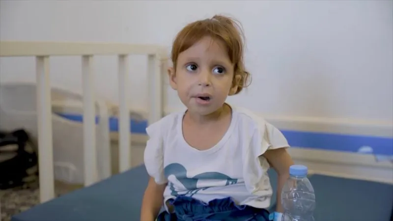 Gaza: niños sufren malnutrición en medio de la crisis alimentaria