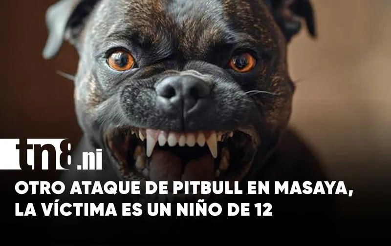 Otro ataque de pitbull: esta vez un menor de 12 años resulta herido en...