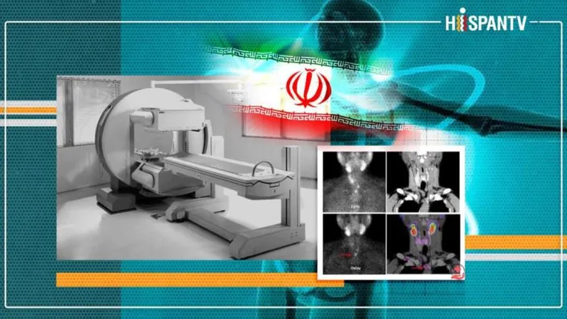 Cómo Irán se unió a la liga de élite de los líderes mundiales en diagnóstico por imagen médica