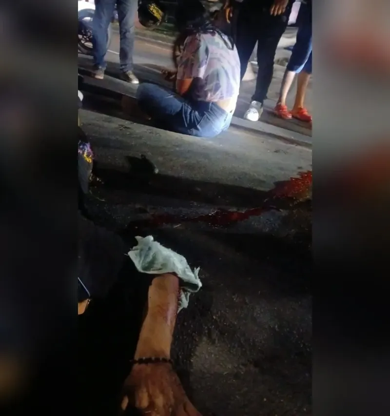 Pareja resulta lesionada al sufrir accidente en moto en carretera Norte, Managua