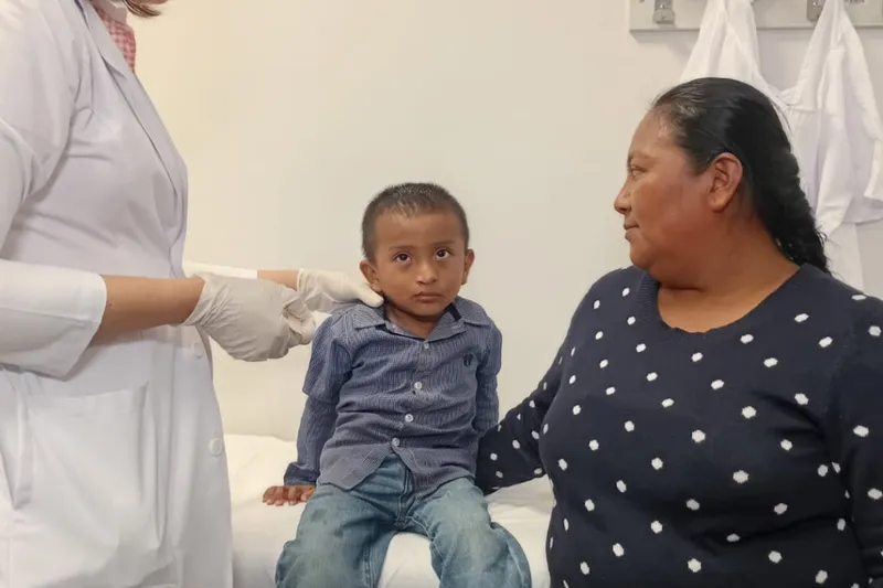 Operan a 20 niños por paladar hendido y labio leporino en Managua
