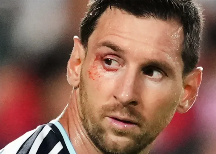 Se acabó la racha goleadora de Messi en el Mundial