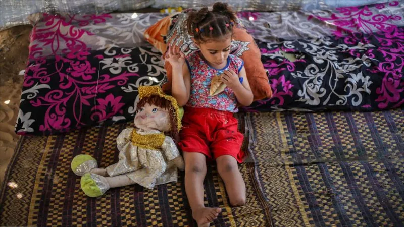 Niña palestina de 4 años sufre amputación por ataque israelí en Gaza