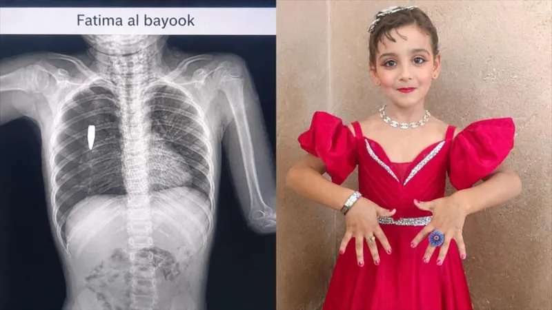Ataques israelíes en Gaza matan a una niña palestina de 8 años