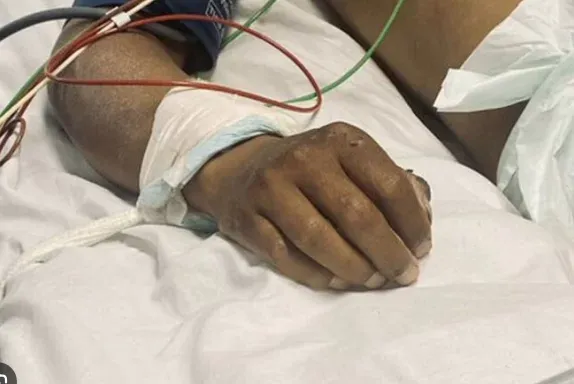 Hombre sobrevive a balazo en el rostro en reserva Indio Maíz, Río San Juan