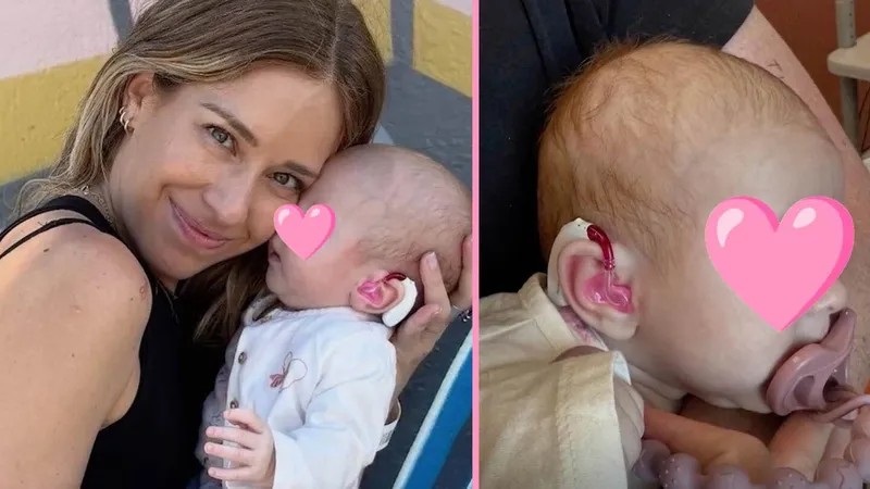 Bebé de Carmen Hub cumple 1 año y debe ser operada para colocarle un implante; nació con PÉRDIDA AUDITIVA