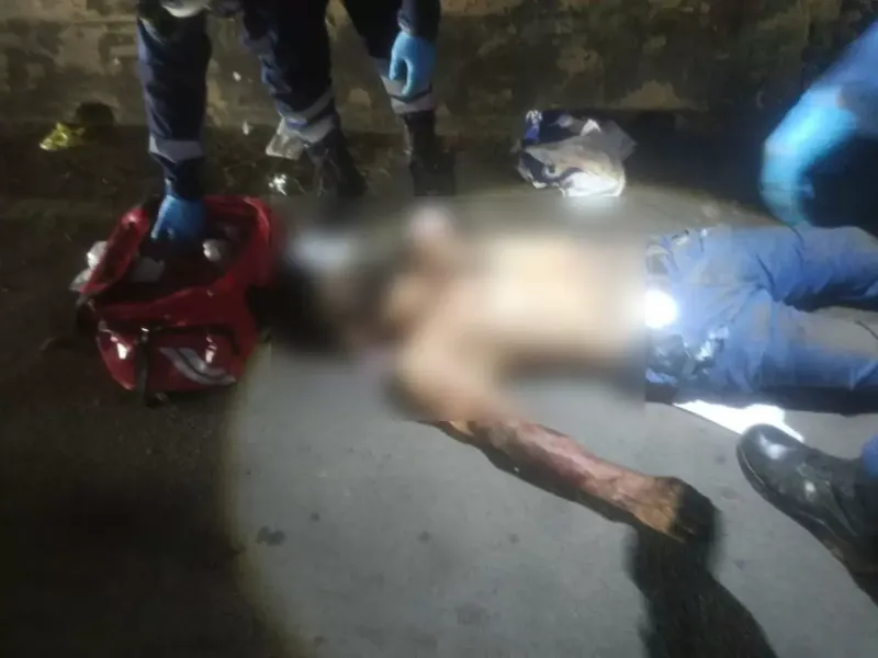 Motociclista pierde un brazo tras chocar ebrio en Managua