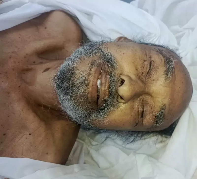 Nagaroteño perece en Hospital Lenín Fonseca tras ser hallado grave en Linda Vista, Managua