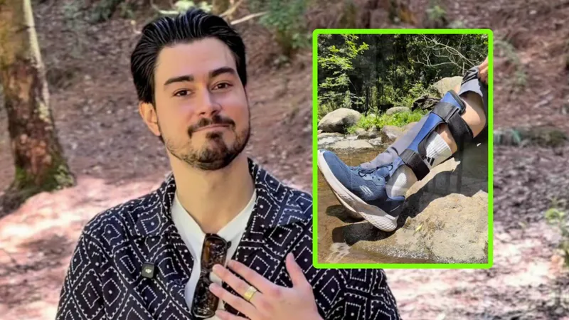 Actor de la serie ‘Narcos’ habla por primera vez de LA AMPUTACIÓN que sufrió en sus vacaciones en Dubái